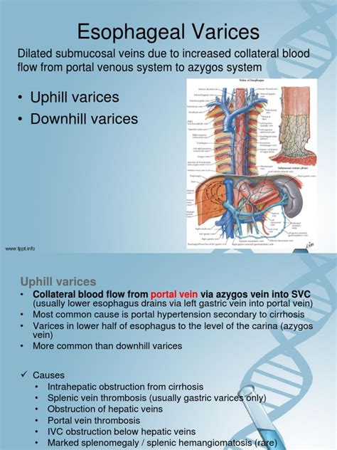 esophageal varices symptoms